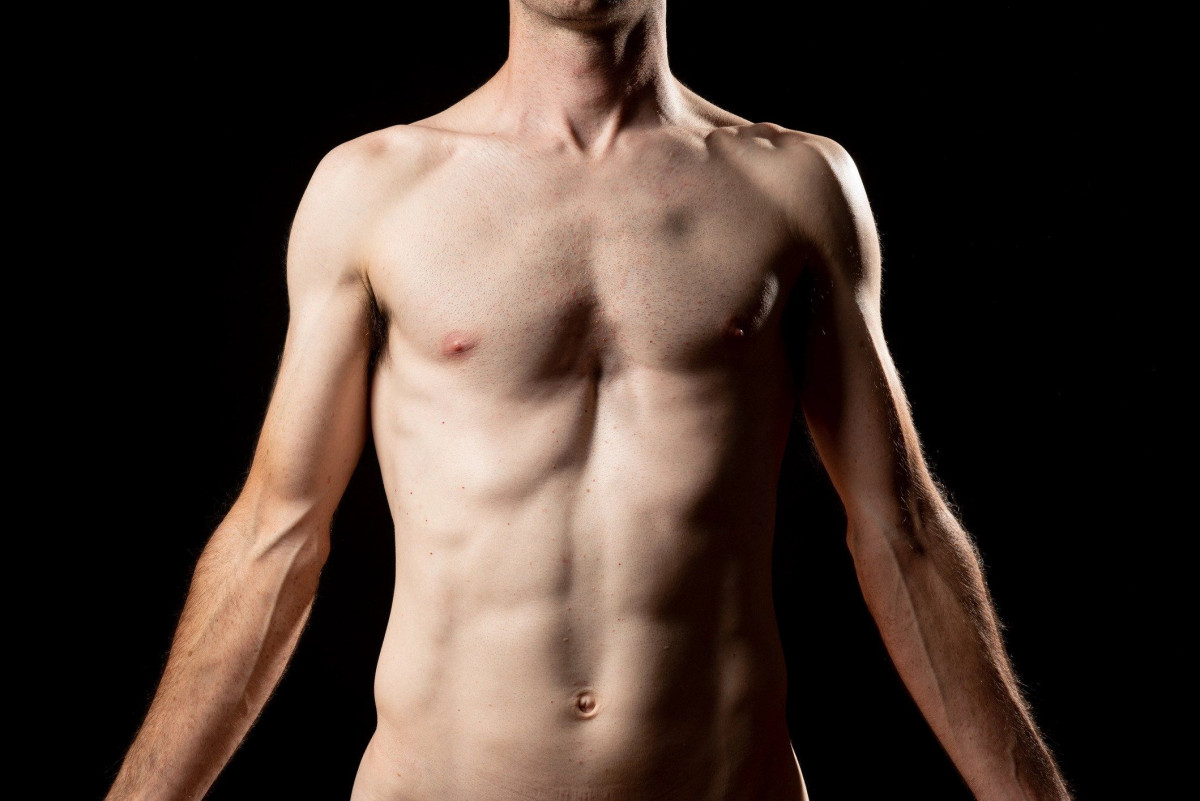 pectus excavatum